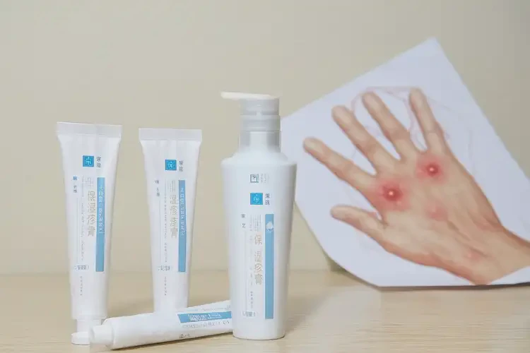 女生手上有濕疹可以徹底自愈嗎(圖3)