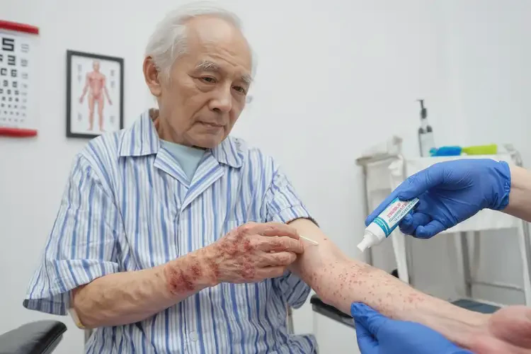 老人手臂出現(xiàn)濕疹可不可以徹底自愈(圖3)