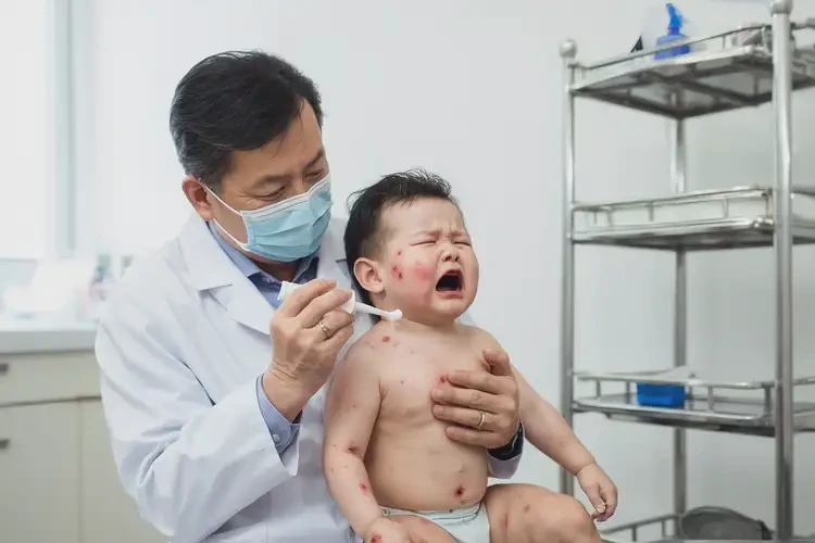 嬰幼兒脖子長濕疹不管它會自己痊愈嗎(圖3)