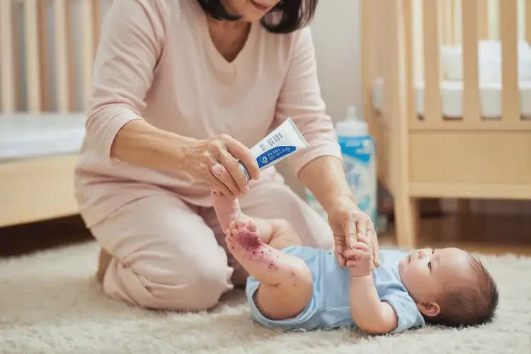 宝宝脚上经常长湿疹不管它会自己痊愈吗(图3)