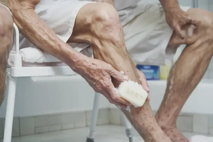 老年人小腿偶爾長(zhǎng)濕疹能靠自己自愈嗎(圖3)