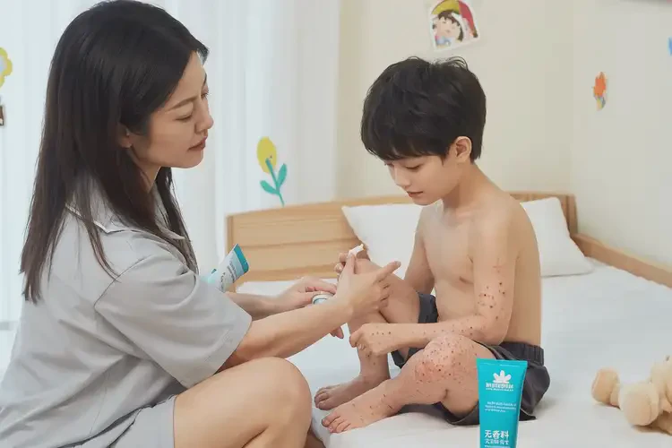 兒童大腿容易長(zhǎng)濕疹能夠徹底治愈嗎(圖3)