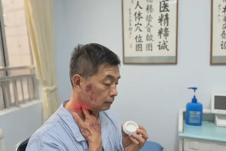 男人脖子起濕疹能夠徹底治愈嗎(圖2)
