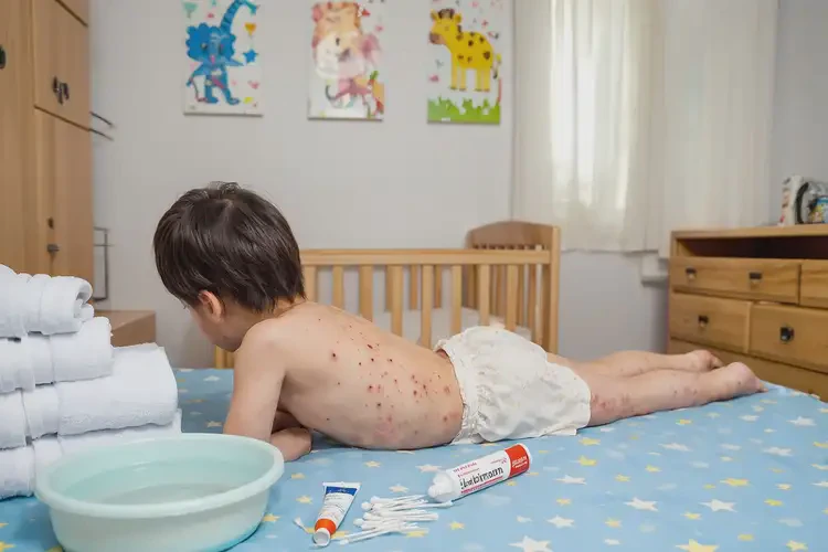 少儿屁股上偶尔起湿疹不管它会自己自愈吗(图2)