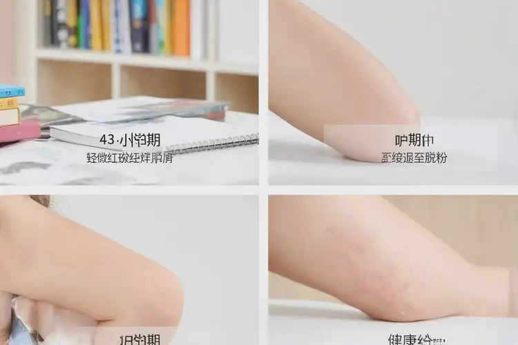 小學生四肢偶爾長濕疹不管它會自己好嗎(圖4)