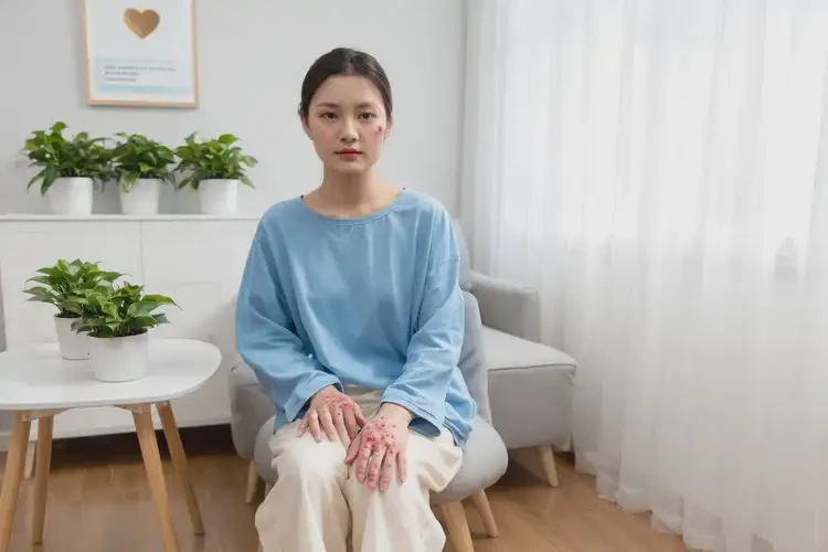 小孩手臂上容易起濕疹不管它會自己好嗎(圖1)