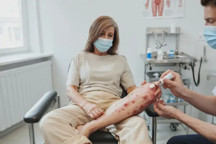 女性大腿出現(xiàn)濕疹能徹底自愈嗎(圖3)