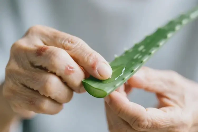 高龄老人手上有湿疹能彻底自愈吗(图3)