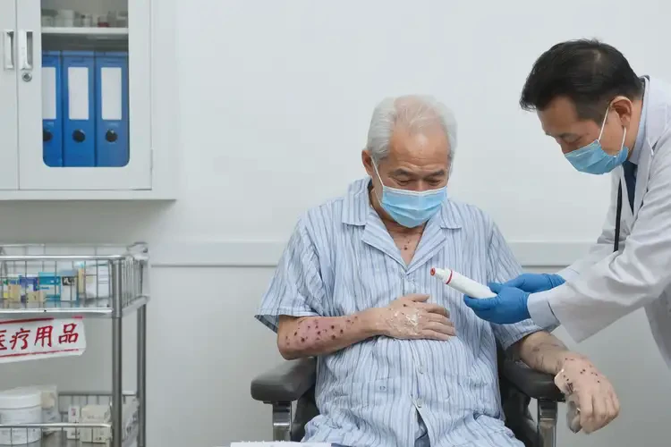 老年人肚子出現(xiàn)濕疹能徹底自愈嗎(圖3)