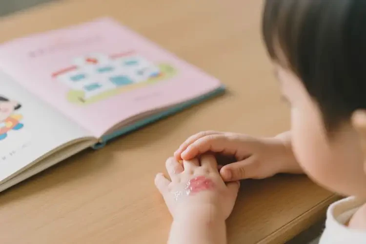 小孩手上起濕疹能徹底自愈嗎(圖2)