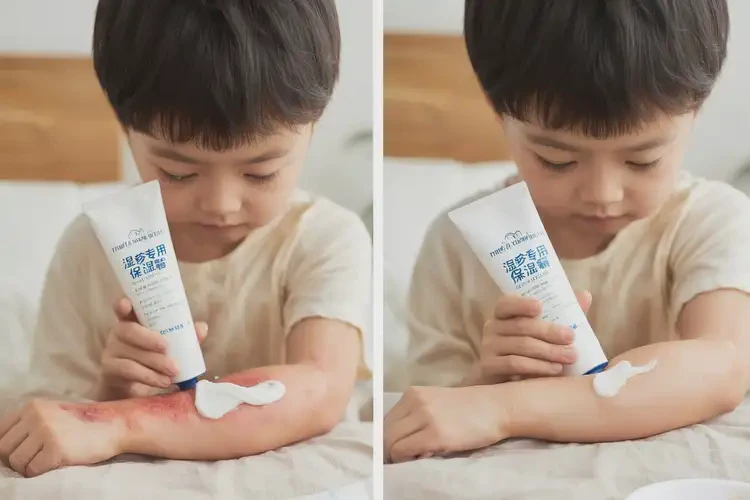 小孩大腿出現(xiàn)濕疹能靠自己自愈嗎(圖2)