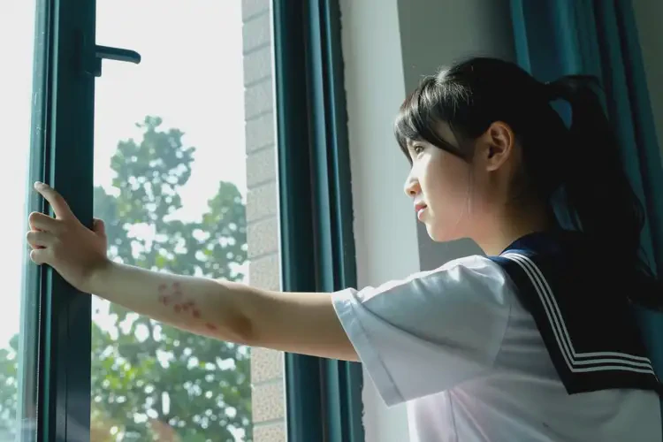 中學(xué)生手臂上有濕疹能靠自己自愈嗎(圖1)