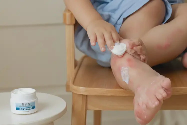 小孩脚上经常长湿疹不管它会自己痊愈吗(图2)