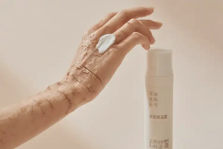 女生臉上容易長(zhǎng)濕疹不管它會(huì)自己痊愈嗎(圖3)