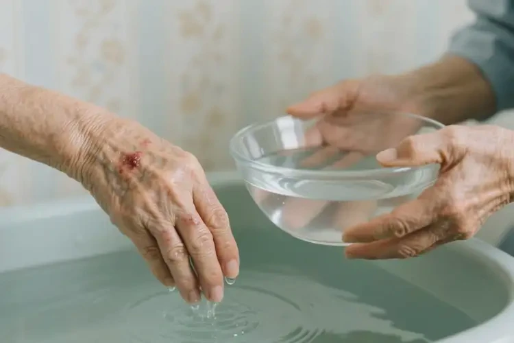 高龄老人手上有湿疹能彻底自愈吗(图1)