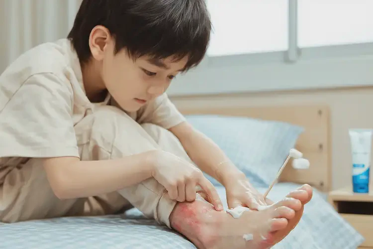 孩子腳上出現(xiàn)濕疹不管它會自己痊愈嗎(圖2)
