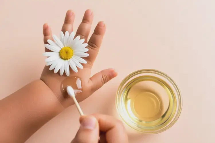 嬰幼兒手上出濕疹可不可以徹底自愈(圖3)