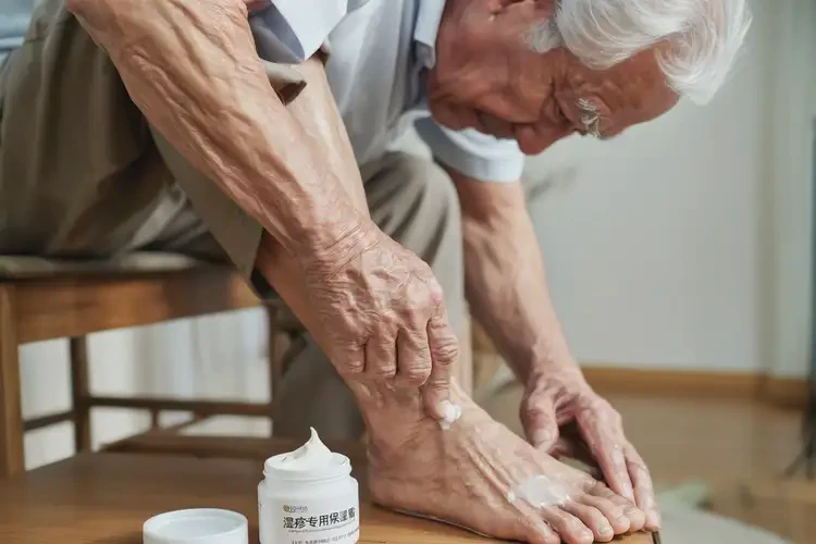 老人腳上經常起濕疹可不可以徹底自愈(圖4)