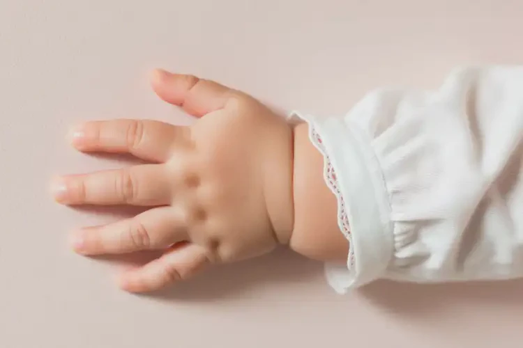 嬰兒手上有濕疹能夠徹底治愈嗎(圖1)