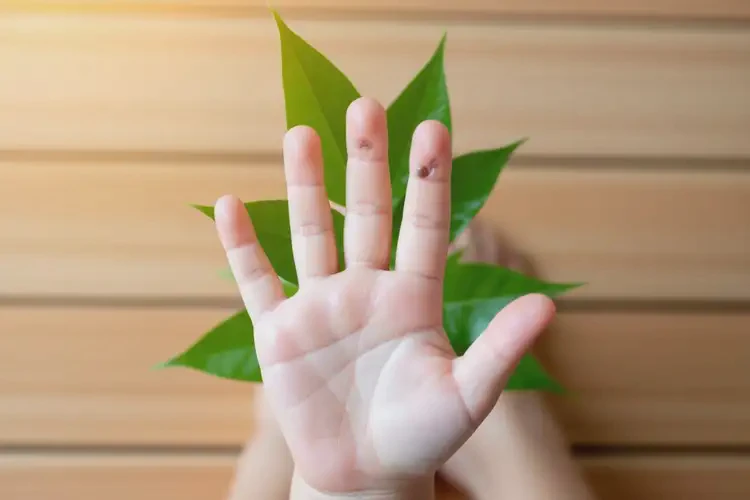 兒童手上容易長濕疹不管它會自己好嗎(圖3)