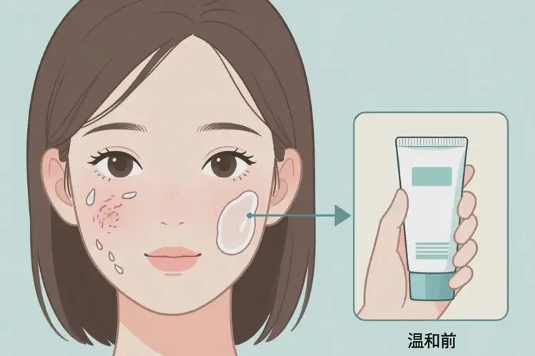 女生面部偶爾長(zhǎng)濕疹能夠徹底治愈嗎(圖4)