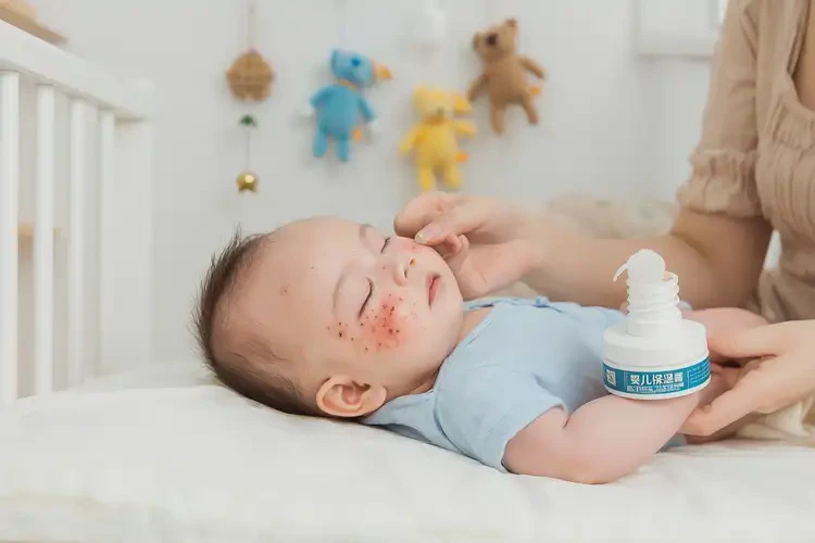 新生兒臉上長濕疹可以徹底自愈嗎(圖3)