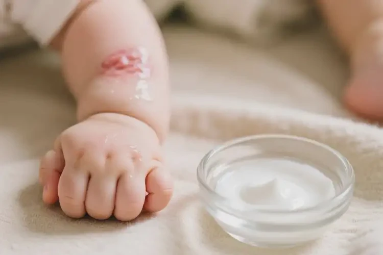 幼兒手臂上長濕疹可不可以徹底自愈(圖3)