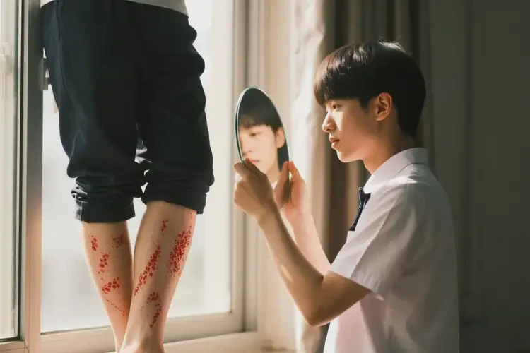 大學生大腿經常起濕疹能夠徹底治愈嗎(圖1)