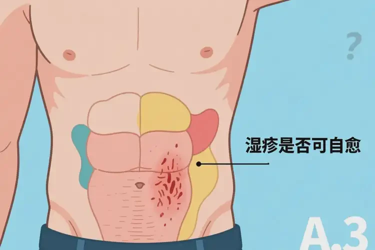 男人肚子容易長濕疹可以徹底自愈嗎(圖3)