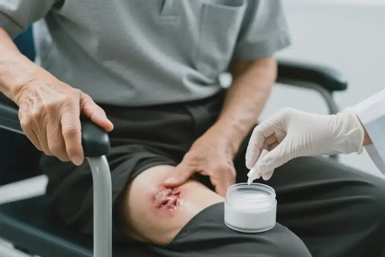 老年人肛周偶爾長(zhǎng)濕疹能夠徹底治愈嗎(圖1)