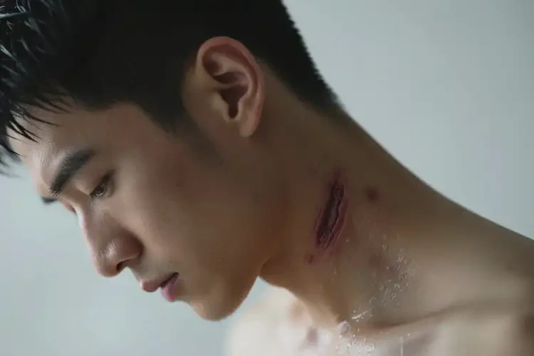 男性脖子起濕疹不管它會(huì)自己好嗎(圖2)