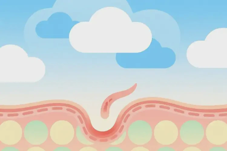 女人大腿偶爾起濕疹能夠徹底治愈嗎(圖1)