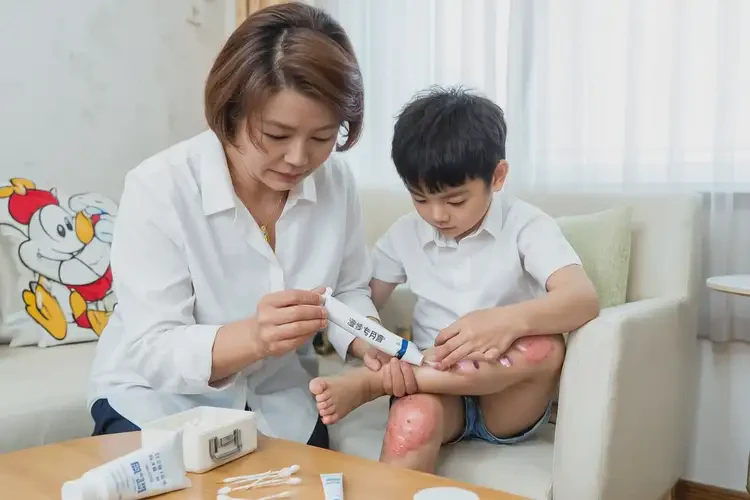 孩子大腿上偶爾長(zhǎng)濕疹能徹底自愈嗎(圖2)