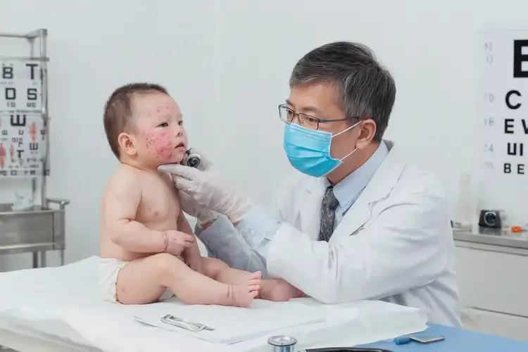 寶寶臉上有濕疹能徹底自愈嗎(圖1)