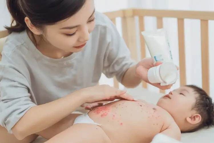 嬰兒肚子有濕疹可以徹底自愈嗎(圖3)