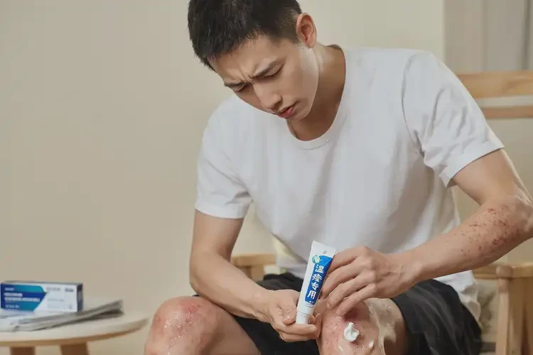 青年人四肢起濕疹可不可以徹底自愈(圖3)