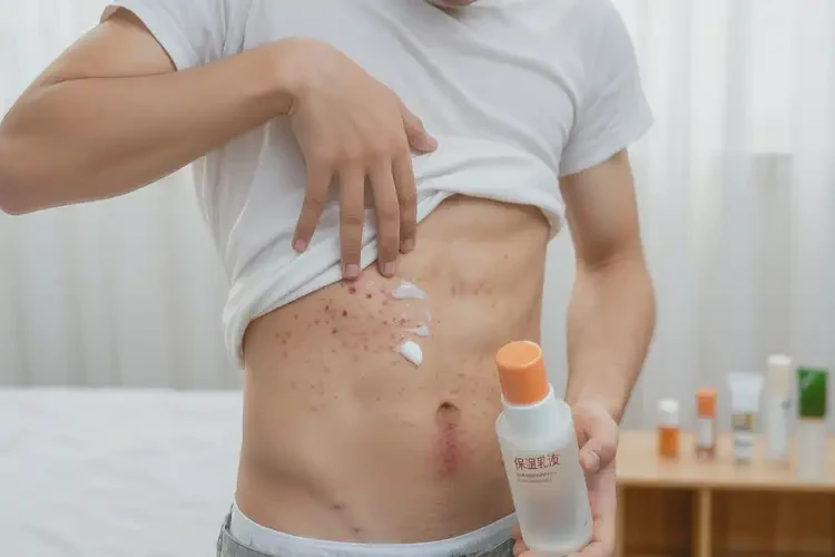 青少年肚子經(jīng)常起濕疹能不能徹底自愈(圖3)