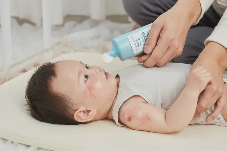 嬰幼兒脖子偶爾長濕疹不管它會自己痊愈嗎(圖3)