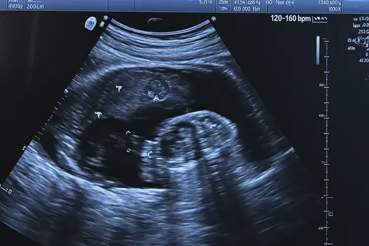 懷孕七個(gè)多月胎心160多寶寶還能要嗎(圖2)