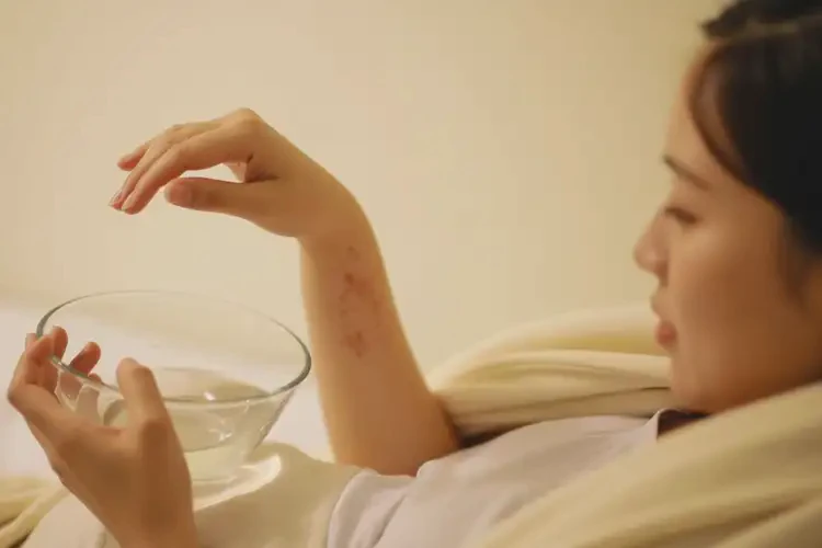 產婦手臂起濕疹能夠徹底治愈嗎(圖3)