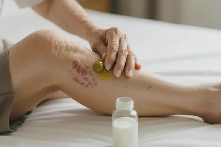 高齡老人大腿偶爾起濕疹不管它會自己自愈嗎(圖1)