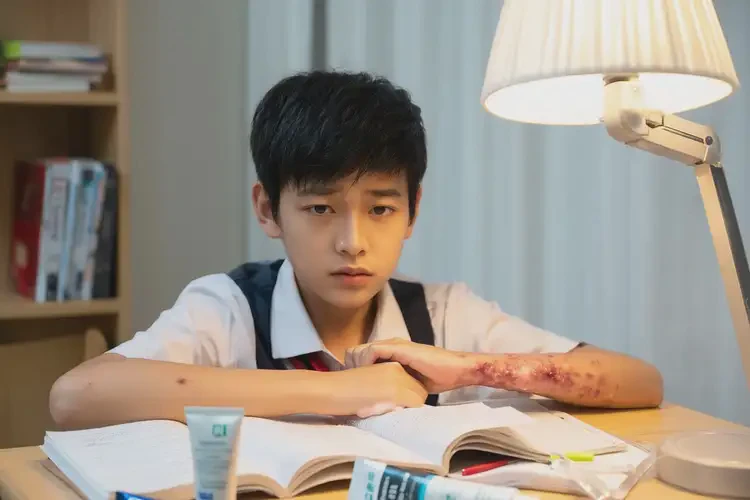 青少年手上容易长湿疹不管它会自己痊愈吗(图1)