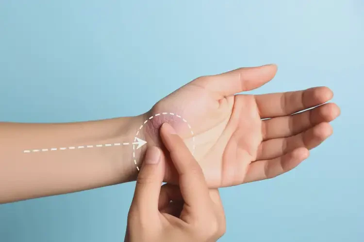 女生手臂經(jīng)常起濕疹能夠徹底治愈嗎(圖2)