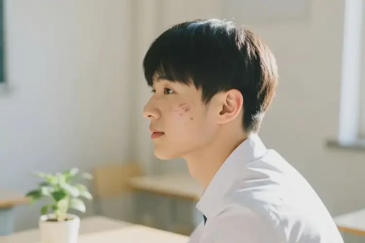 大学生面部长湿疹可以彻底自愈吗(图4)