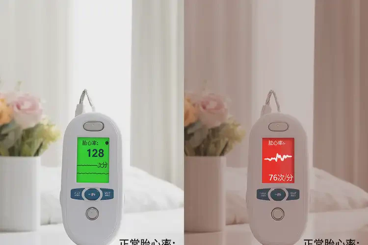 孕38周5天胎心率76有危險(xiǎn)嗎(圖3)