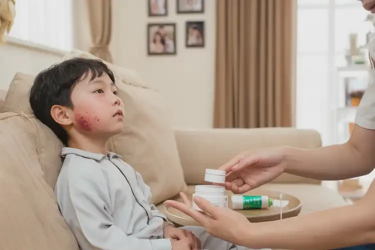 小兒脖子經(jīng)常起濕疹不管它會(huì)自己痊愈嗎(圖3)