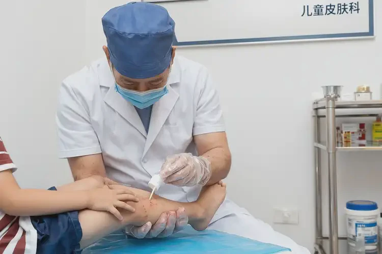 兒童小腿上出濕疹可不可以徹底自愈(圖3)