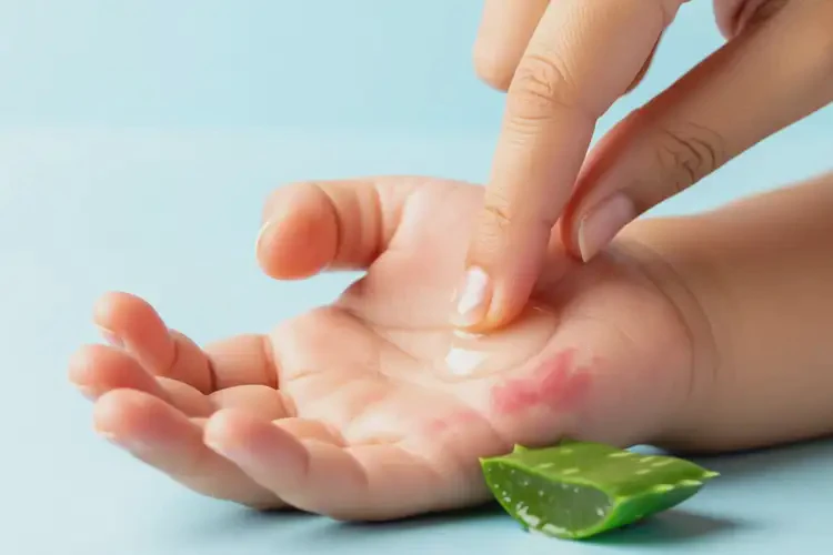 嬰幼兒手上出濕疹可不可以徹底自愈(圖4)