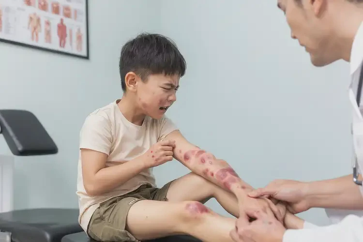 小孩四肢容易長(zhǎng)濕疹能徹底自愈嗎(圖4)