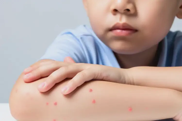 小學生手臂上起濕疹不管它會自己痊愈嗎(圖4)